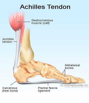 Achilles Tendon Rupture: Treatment, Test, Symptoms & Recovery Times