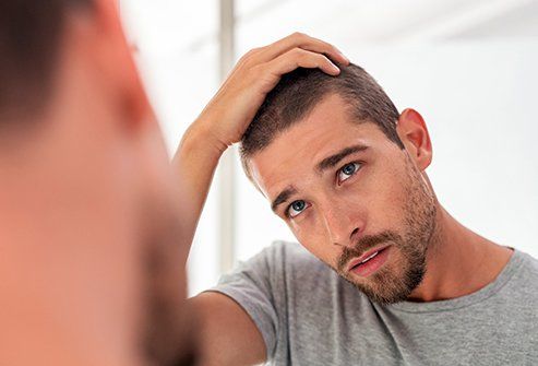 20 Effective Ways to Stop Hair Loss in Men