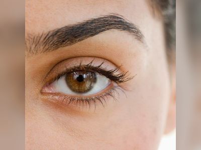 Eyelid Dermatitis: What Doctors Need You to Know