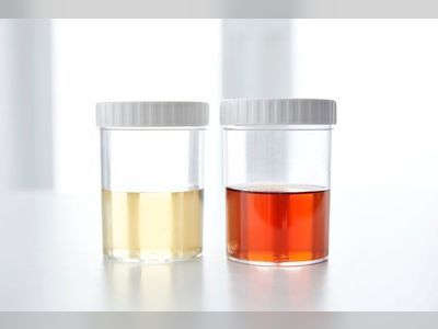 This Urine Colour Chart Reveals Exactly What Your Pee Colour Means