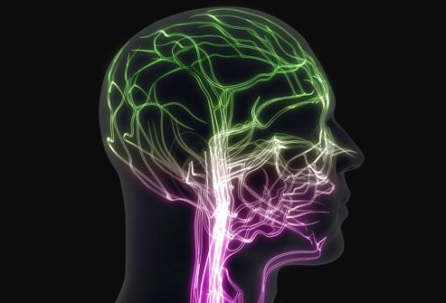 A Visual Guide to Migraine Headaches