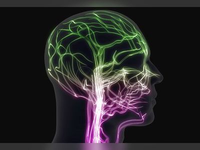 A Visual Guide to Migraine Headaches