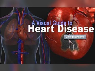 Heart Disease: Causes of a Heart Attack