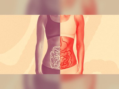 It's Important to Know the Difference Between Diverticulosis and Diverticulitis