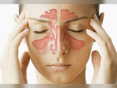 Sinus Infection (Sinusitis) Symptoms & Treatment